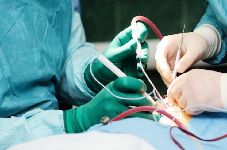 Brain Tumor Surgery-------28